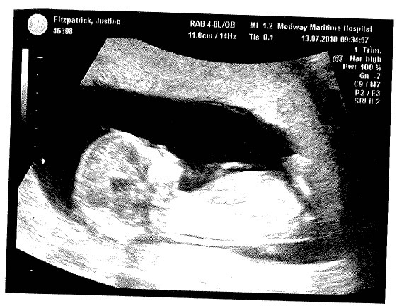 Scan pic 1